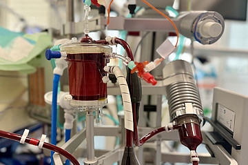 Extrakorporalen Membranoxygenierung (ECMO)
