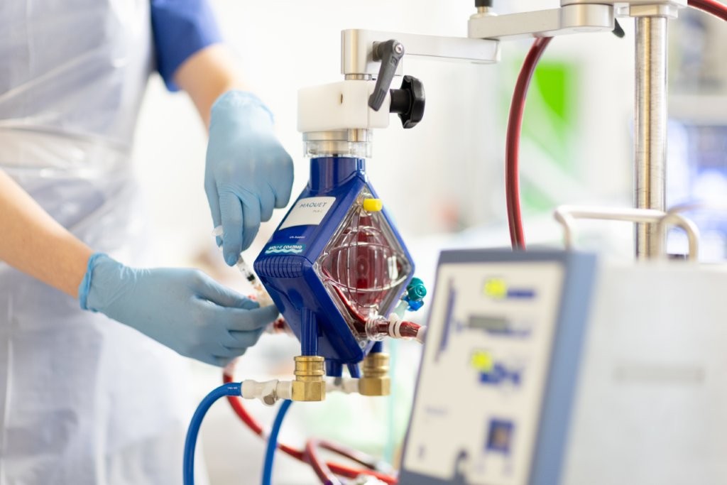 ECMO-Maschine versorgt Blut mit Sauerstoff