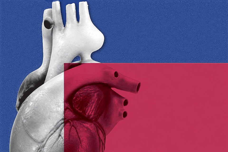 Anatomisches Modell eines menschlichen Herzens vor blauem Hintergrund mit rotem halbtransparentem Rechteck im Vordergrund