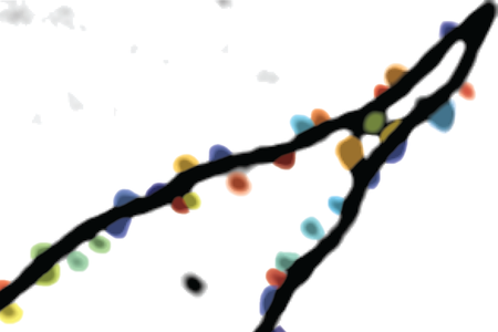 Das Bild zeigt eine Aufnahme aus der Forschung, den Fortsatz einer Nervenzelle mit bunten Punkten darauf, die die synaptischen Eingänge darstellen.