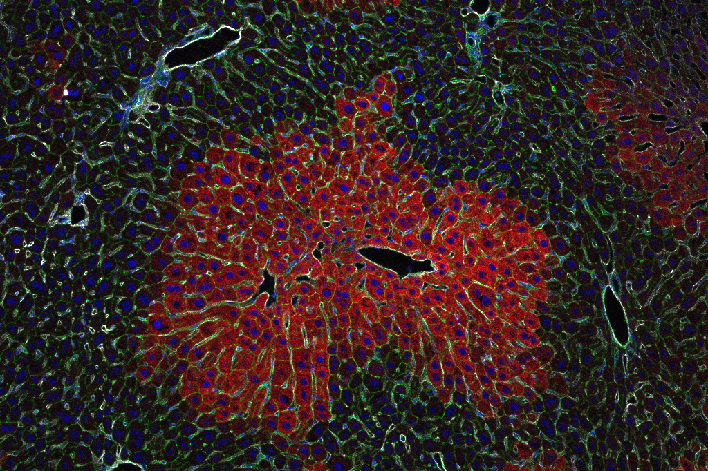 Das Foto zeigt eine wissenschaftliche Aufnahme, einen Leberschnitt, der unterschiedliche Zonen erkennen lässt.